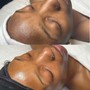 Gentlemen’s Facial Treatment