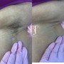 Underarm Wax