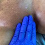 Facial