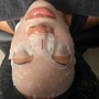 Royal Facial Back