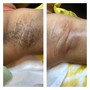 Women’s Brazilian Wax