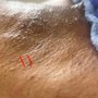 Men’s Brazilian Wax