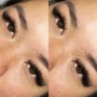 Eyelash Extension Removal