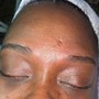 Glycolic Peel Facial