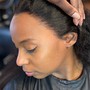 Scalp Treatment