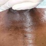 Men's Back Wax (Half)