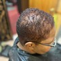 Scalp Treatment