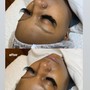 Back Facial