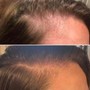 Scalp Detox Treatment