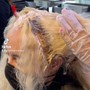 Scalp Treatment