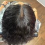 Scalp Treatment with growth  stimulation for growth