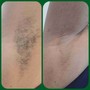 Underarm Wax