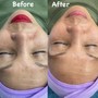 "The intro" Express Facial