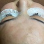 Eyelash Extension Removal