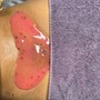 Women’s Brazilian Wax