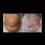 Brazilian Wax Package  of 2