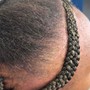 Alopecia Enhancement