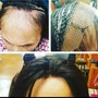 Scalp Treatment