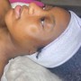 High Frequency Facial Treatment