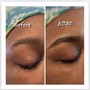 Eyelash Extension Removal