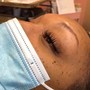 Eyelash Extension Removal