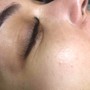 Eyelash Extension Removal