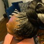 Scalp Treatment