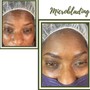 Extended Chemical peel