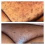 Underarm Sugaring