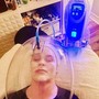 Microneedling (Face + Neck)