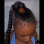 Scalp Treatment