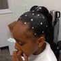 Scalp Treatment