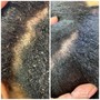 Scalp Treatment