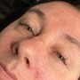 Eyelash Extension Removal