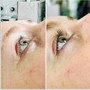 Lash Extension Removal