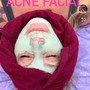 Acne Facial