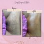 Dermaplaning (ADD ON)