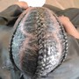 Scalp Treatment