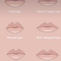 Lip Fillers- Juvéderm, Restylane Kysse and so many other brands for lips