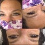 Eyelash Extension Removal