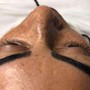 Eyelash Extension Removal