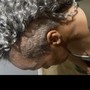 Scalp Treatment