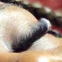 Eyelash Extension Removal