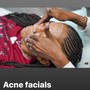 Acne Facial