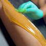 Full Back Sugaring