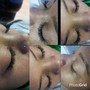 Dermaplaning Egyptian facial