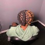 Scalp Treatment