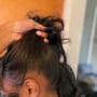 Scalp Treatment