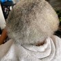 Scalp Treatment