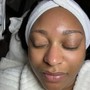 Dynamic Acne Facial